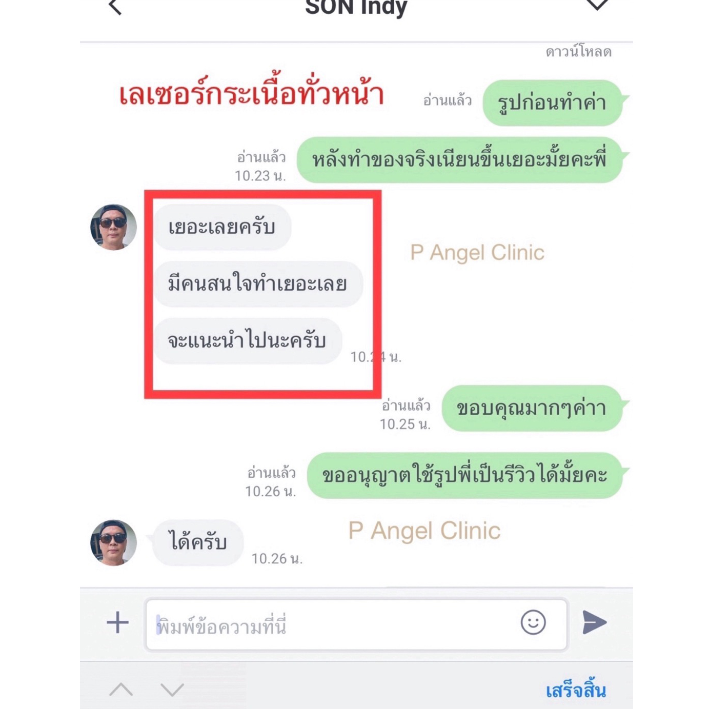 11 - https://พีแองเจิลคลินิก.com | P Angel Clinic ให้บริการเลเซอร์ติ่งเนื้อ กระเนื้อด้วย CO2 Laser ไม่ทิ้งรอยแผลเป็น 11 - https://พีแองเจิลคลินิก.com | P Angel Clinic ให้บริการเลเซอร์ติ่งเนื้อ กระเนื้อด้วย CO2 Laser ไม่ทิ้งรอยแผลเป็น