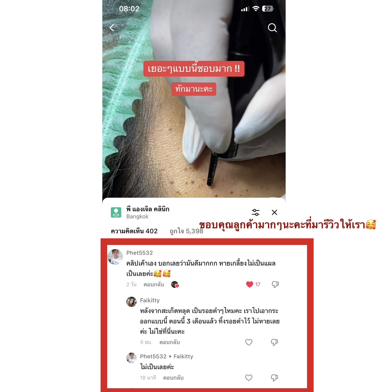14 - https://พีแองเจิลคลินิก.com | P Angel Clinic ให้บริการเลเซอร์ติ่งเนื้อ กระเนื้อด้วย CO2 Laser ไม่ทิ้งรอยแผลเป็น 14 - https://พีแองเจิลคลินิก.com | P Angel Clinic ให้บริการเลเซอร์ติ่งเนื้อ กระเนื้อด้วย CO2 Laser ไม่ทิ้งรอยแผลเป็น