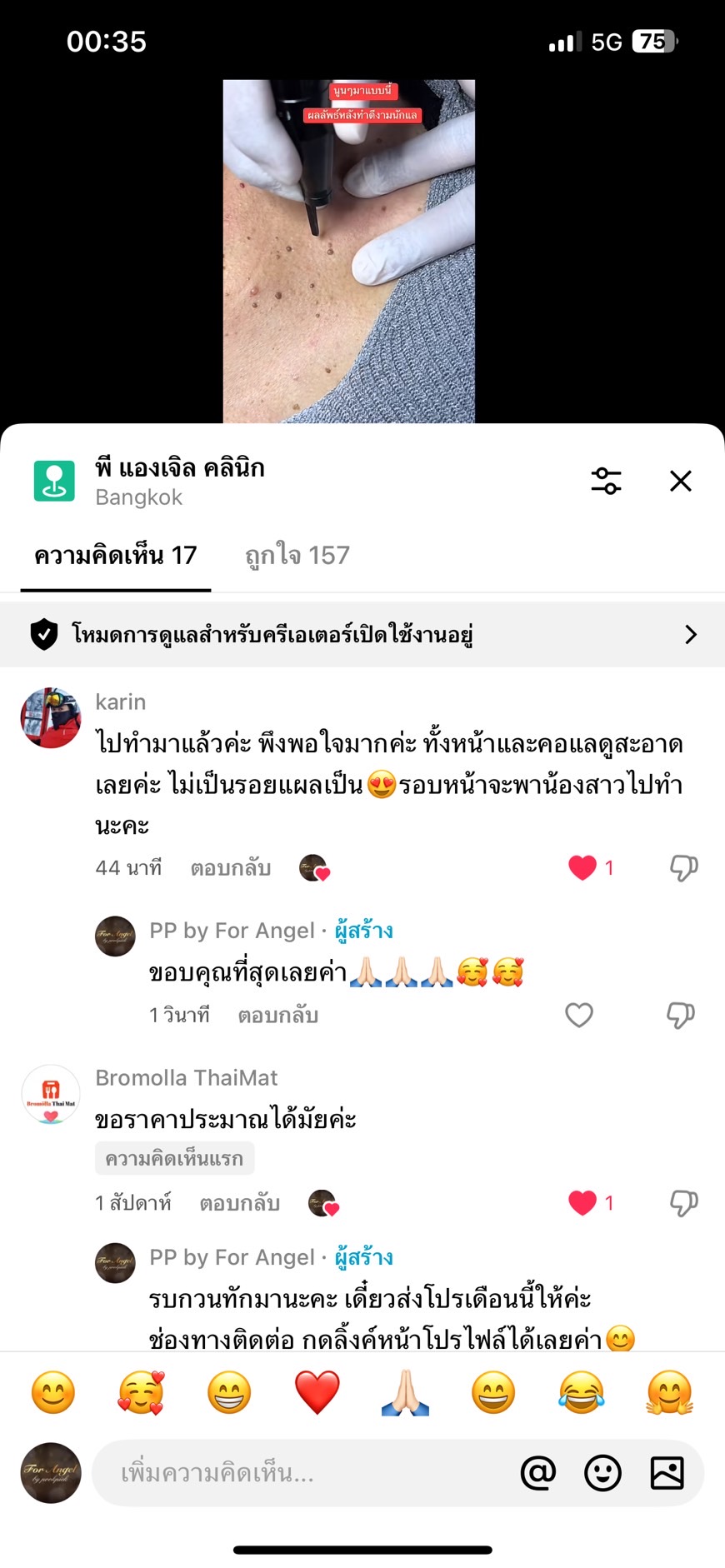 39 - https://พีแองเจิลคลินิก.com | P Angel Clinic ให้บริการเลเซอร์ติ่งเนื้อ กระเนื้อด้วย CO2 Laser ไม่ทิ้งรอยแผลเป็น 39 - https://พีแองเจิลคลินิก.com | P Angel Clinic ให้บริการเลเซอร์ติ่งเนื้อ กระเนื้อด้วย CO2 Laser ไม่ทิ้งรอยแผลเป็น