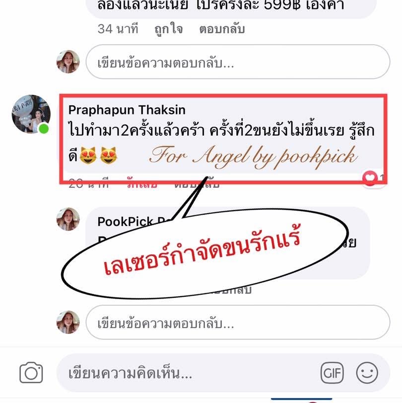 P Angel Clinic ให้บริการเลเซอร์ติ่งเนื้อ กระเนื้อด้วย CO2 Laser ไม่ทิ้งรอยแผลเป็น